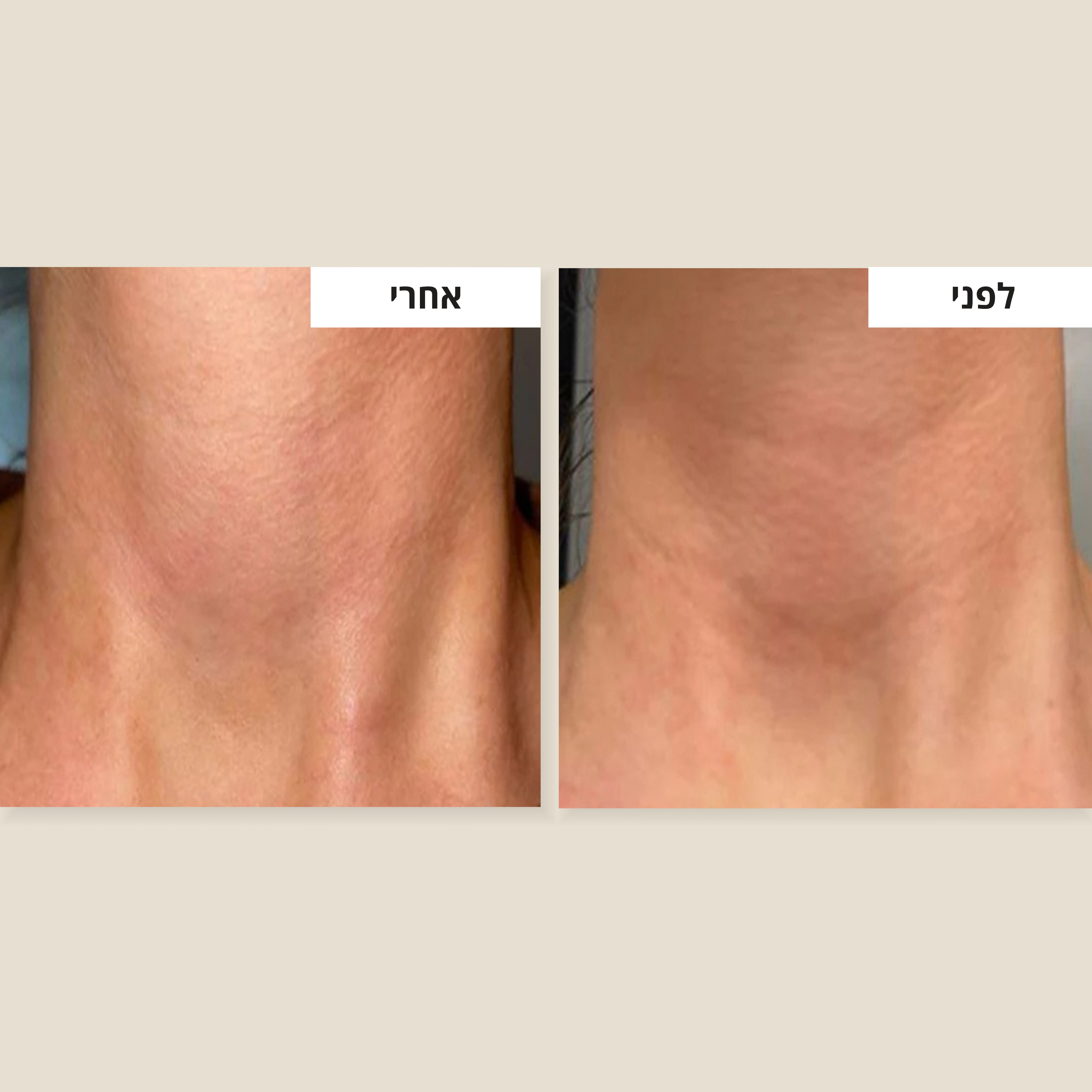 קרם למיצוק הצוואר