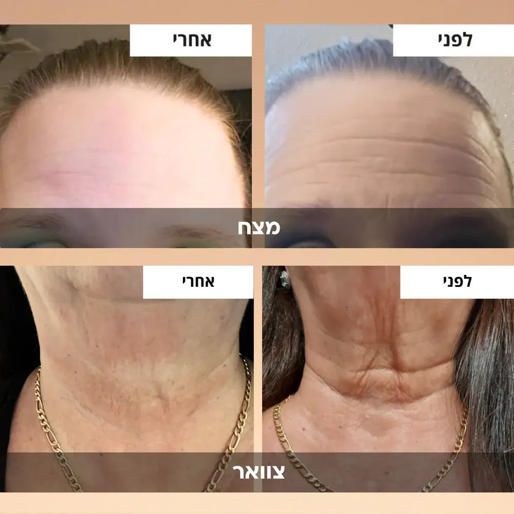 VERRA | קרם אנטי אייג׳ינג