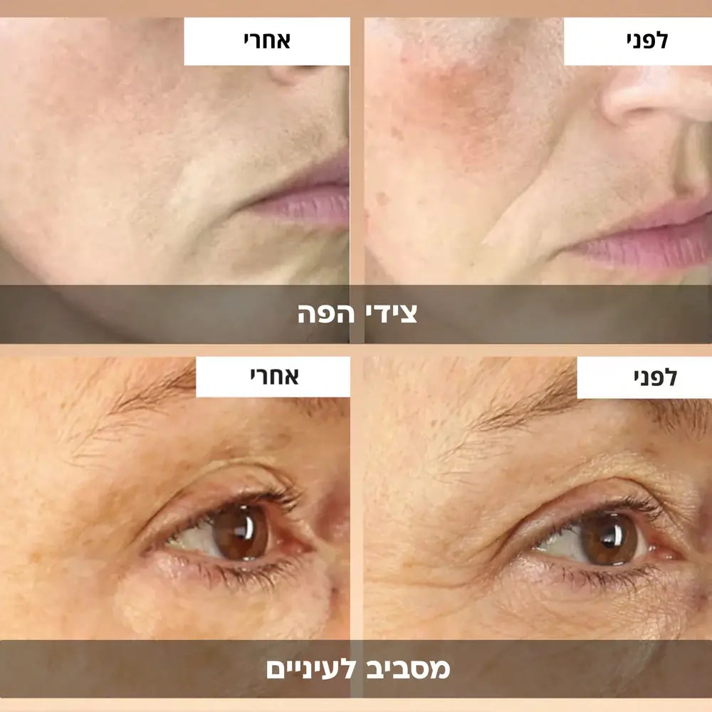 VERRA | קרם אנטי אייג׳ינג